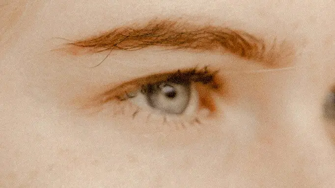 jordi miquel blefaroplastia 2 1 uai