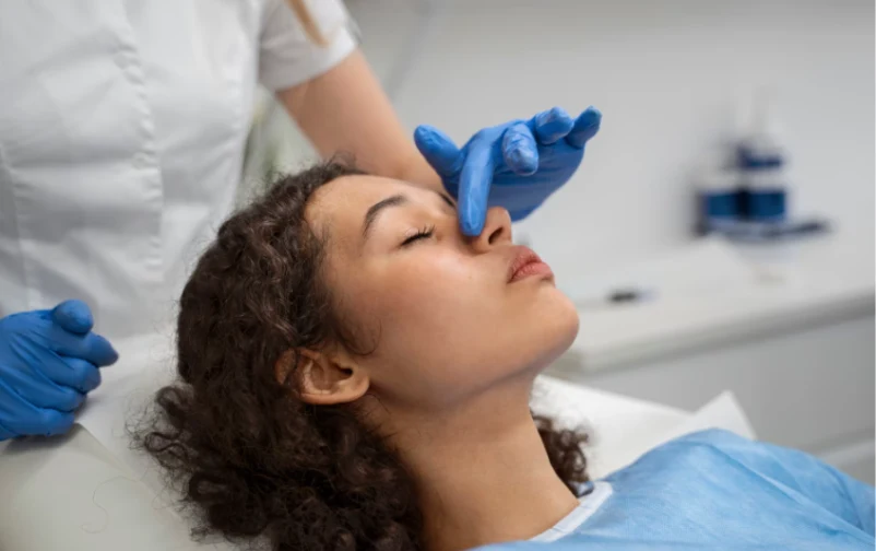 Como evitar congestion nasal tras rinoplastia ultrasonica en Barcelona