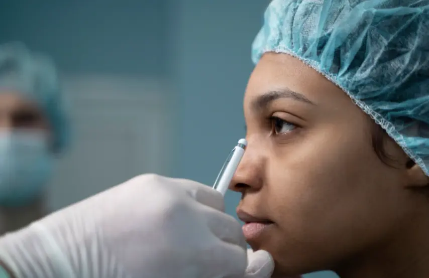 Nariz desviada rinoplastia ultrasonica en barcelona con dr jordi miquel