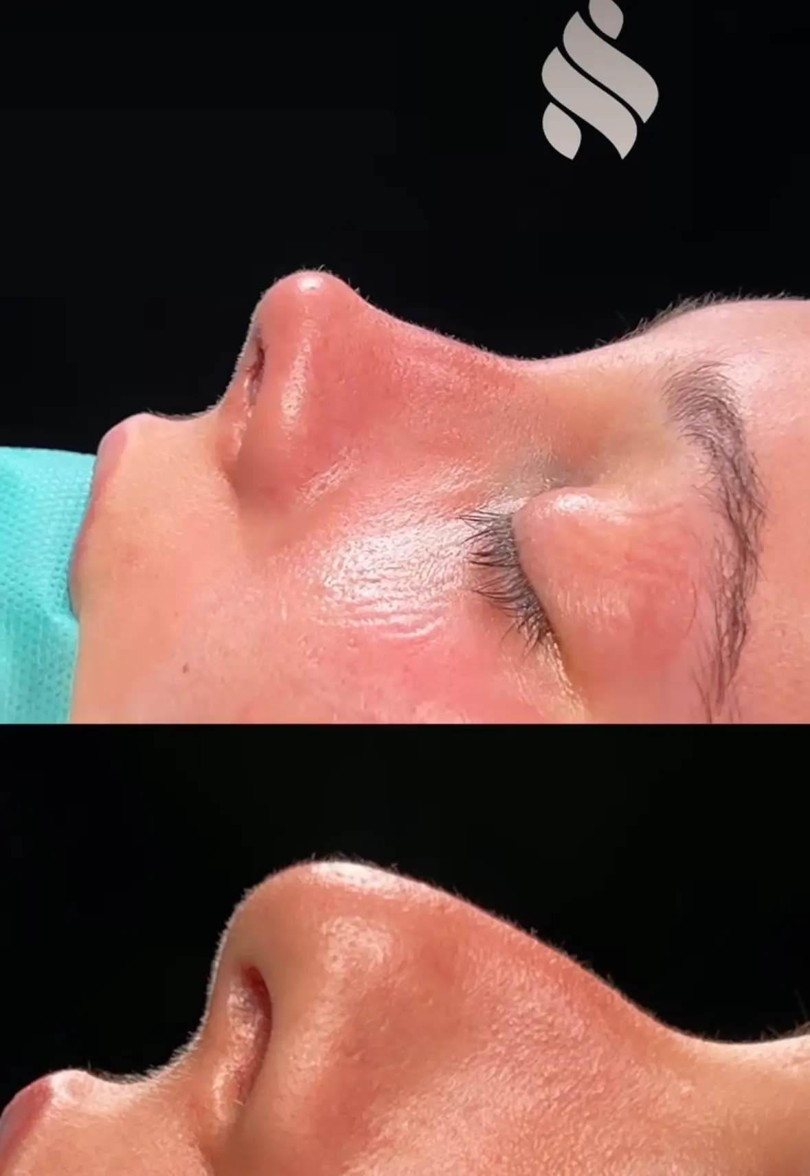 Nariz griega Dr Jordi Miquel