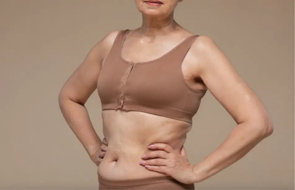 Postoperatorio aumento de pecho en Barcelona por Dr Jordi Miquel